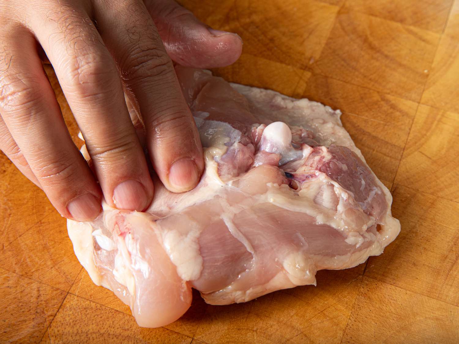 Overhead view of locating the bone